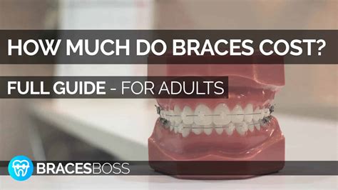 how much are cheap braces